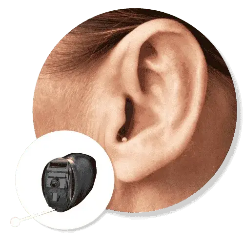 Close-up of a custom invisible hearing aid being fitted comfortably inside the ear canal